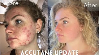 Do I Regret Going on Accutane?!? | Month 6, 7, 8 Update **SHOCKING RESULTS**