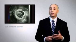 Endoscopic Ultrasound - Mayo Clinic