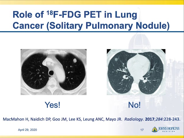 When, and When Not, to Use PET/CT Part 1