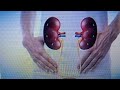 Treatment Of Urinary Bladder Infections Using The Al Tayyibat System As Featured On My Channel 