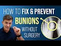 How to fix  prevent bunions without surgery