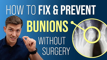 How to Fix & Prevent Bunions Without Surgery!