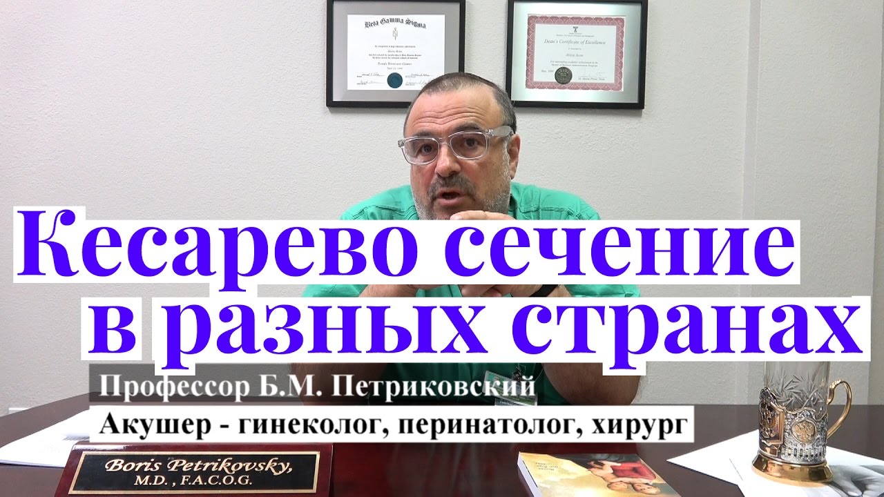 Причины большого количества кесаревых сечений в западных странах - YouTube