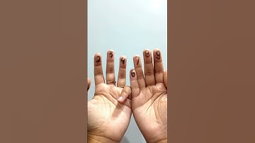 Trik, menghitung perkalian 9 cepat pake tangan #shorts #matematika #perkalian #jarimatika