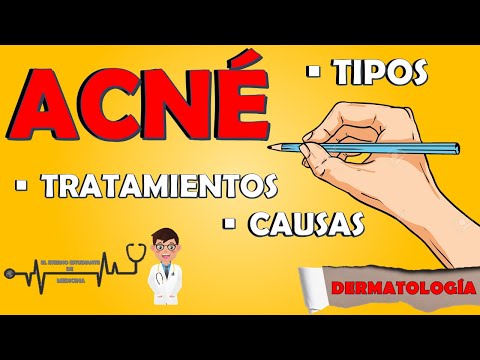 Vídeo: Tipos De Acné: Imágenes, Tratamientos Y Más