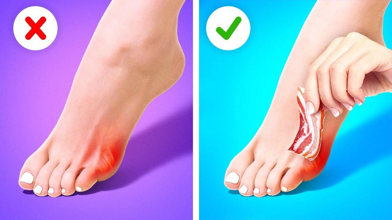 SMART FIRST-AID HACKS EVERYONE SHOULD KNOW