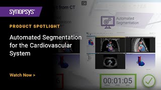 Automated Segmentation with Simpleware Software for the Cardiovascular System screenshot 5