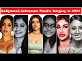 Bollywood Actresses Plastic Surgery Before and After | 2023 | Parineeti Chopra, Janhvi Kapoor, Nysa