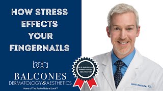 How Stress Affects Your Fingernails | David Bushore, M.D. | Austin, TX | Ph:512-459-4869