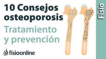 ¿Ayuda caminar a combatir la osteoporosis?