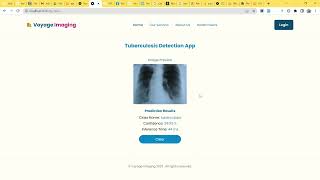 Tuberculosis (TB) Detection from Chest X-ray using Deep Learning (PyTorch)  | A Healthcare App screenshot 5