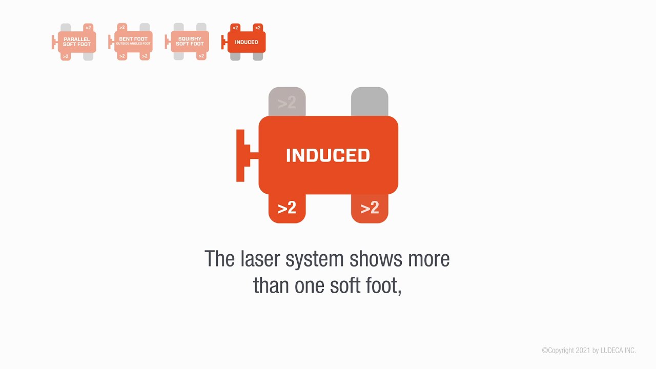 Find-and-Fix Soft Foot [Motion Graphic]