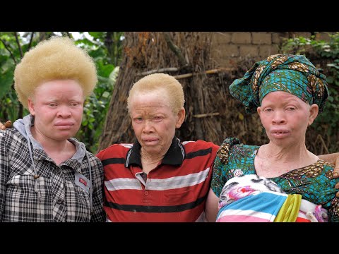 Born Too White: