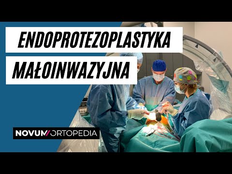 Małoinwazyjna endoprotezoplastyka biodra i kolana. | Novum Ortopedia