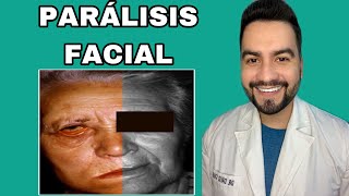 Tengo Paralisis Facial Paralisis De Bell Paralisis Facial Periferica Dr David Campos