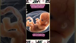 What a 10-Week Baby Actually Looks Like! 👶