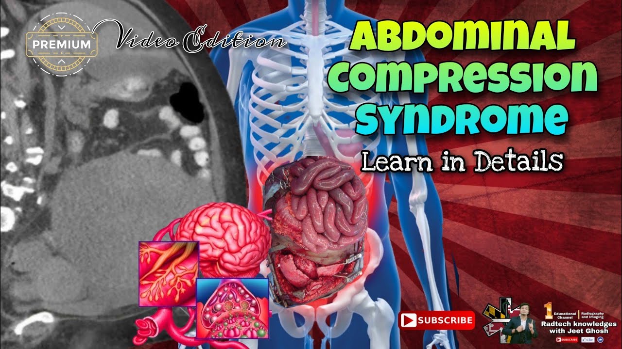 ABDOMINAL COMPARTMENT SYNDROME CLINICAL PRESENTATION AND RADIOLOGICAL