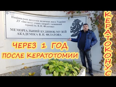 Кератоконус | Спустя 1 год после операции в клинике Арцыбашева | Ответы на часто задаваемые вопросы