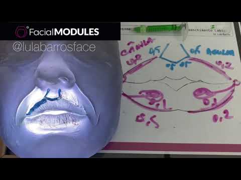 04 - Técnica preenchimento Labial com Canula 22G e Agulha