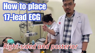 How to install a right and posterior ECG - 17 lead ECG - tutorial