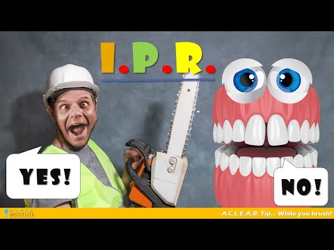 Are you afraid of Interproximal Reduction (IPR)