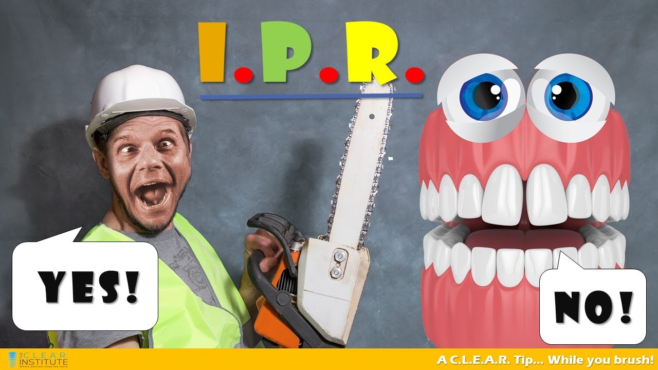 Are you afraid of Interproximal Reduction (I.P.R.)