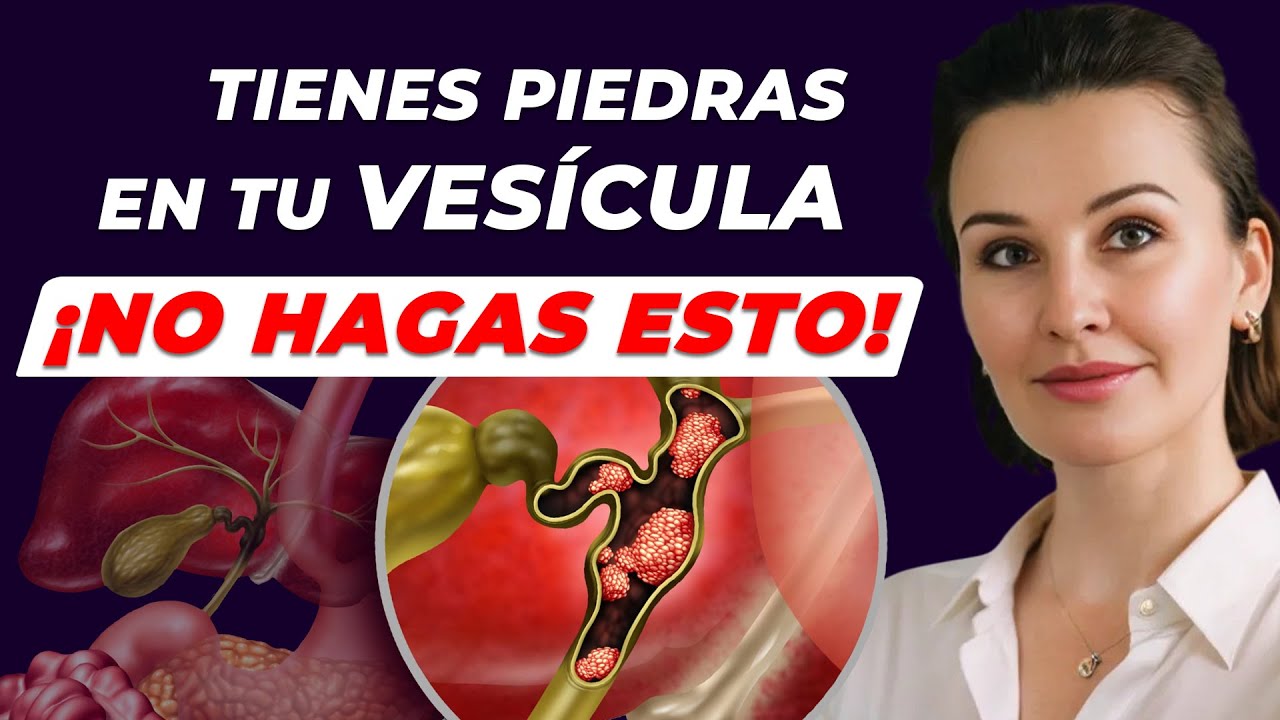 Cómo DISOLVER Cálculos en VESÍCULA sin Riesgos y Complicaciones