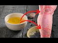 Mix Olive Oil and Garlic and Say Goodbye To Varicose Veins