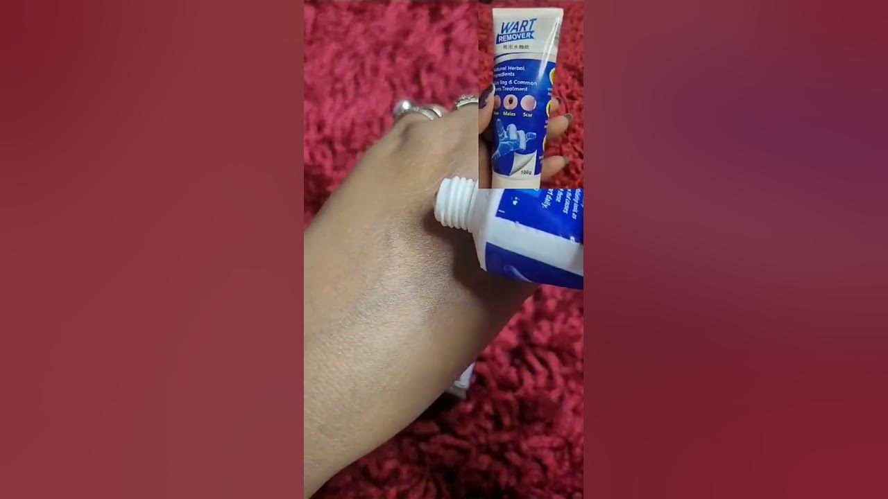 wart-remover-ointment-reviews-does-wart-removal-really-work-honest