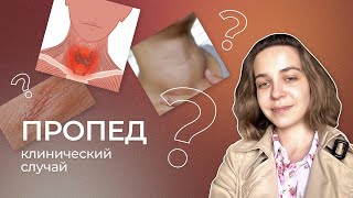 Клинический случай: эндокринология | Пропедевтика