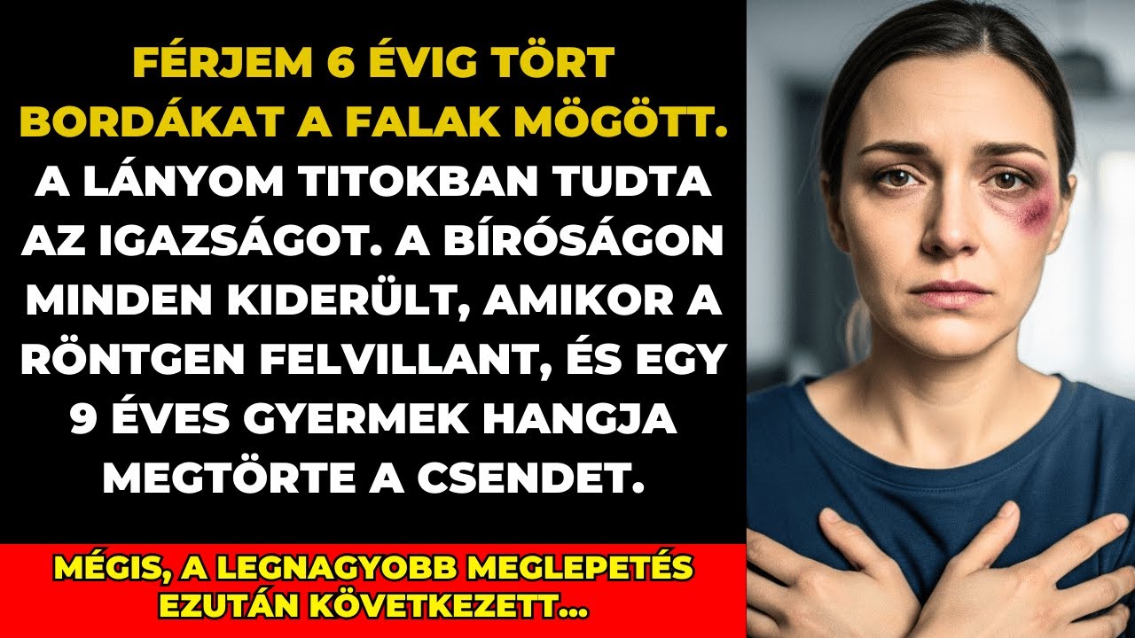 Férjem eltörte bordáimat—A bíró felemelte a röntgent és lányom sírva állt fel...