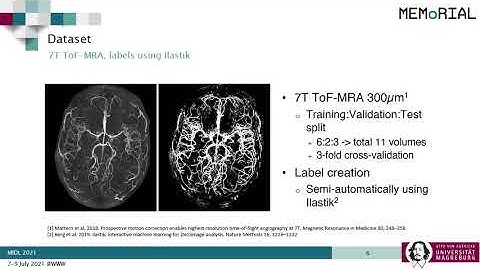 MIDL 2021, K4, Chatterjee et. al., Short Oral