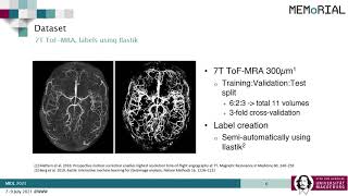 MIDL 2021, K4, Chatterjee et. al., Short Oral