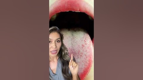 Tip to Get Rid of Stinky Bad Breath