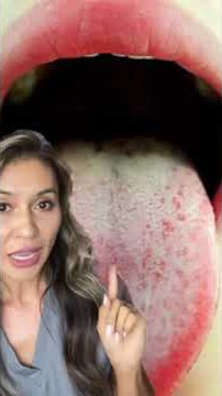 Tip to Get Rid of Stinky Bad Breath