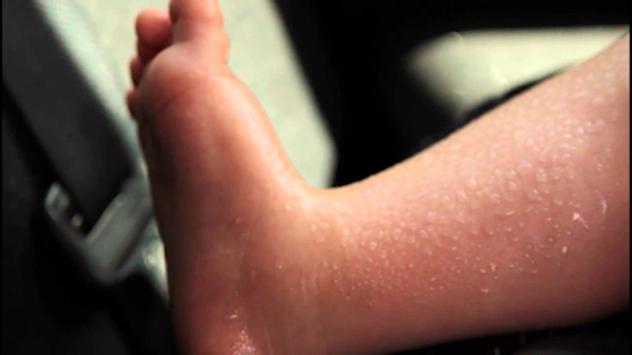 PSA Safe Summer (TM24 Productions)