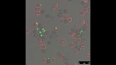 Time-lapse video microscopy of the formation and breakdown of the parasitophorous vacuole