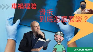【潘弟】了解車禍理賠案例｜理賠技巧教會你｜(肋骨骨折篇)