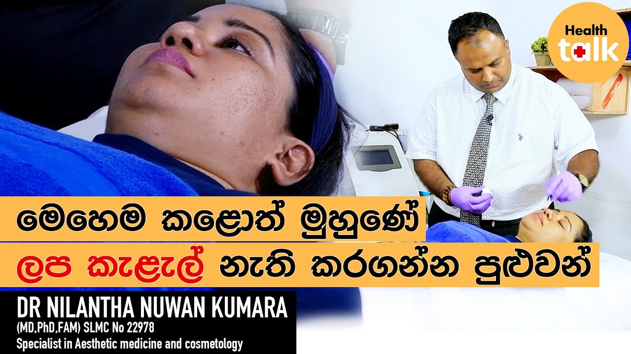මෙහෙම කළොත් මුහුණේ ලප කැළැල් නැති කර ගන්න පුළුවන් - Dr. Nilantha Nuwan ...