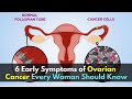 6 Early Symptoms of Ovarian Cancer Every Woman Should Know