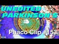 Phaco clip 153  wedge on parkinsons