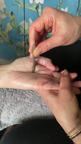 plexus solaire avec bâton d'acupression