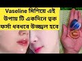Vasline মিশিয়ে এই উপায় কি একদিনে ত্বক ধবধবে উজ্জ্বল হবে ✅