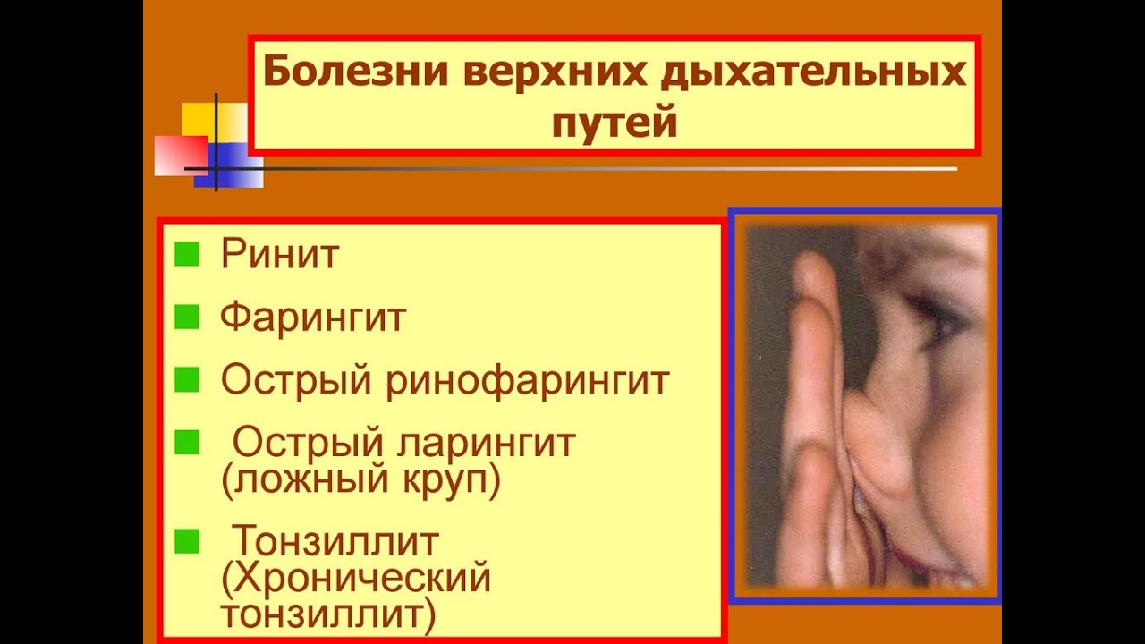 9. острая инфекция дыхательных путей неуточненная. острые заболевания дыхательных путей. 9 - острая инфекция верхних дыхательных путей. острая инфекция верхних дыхательных путей.