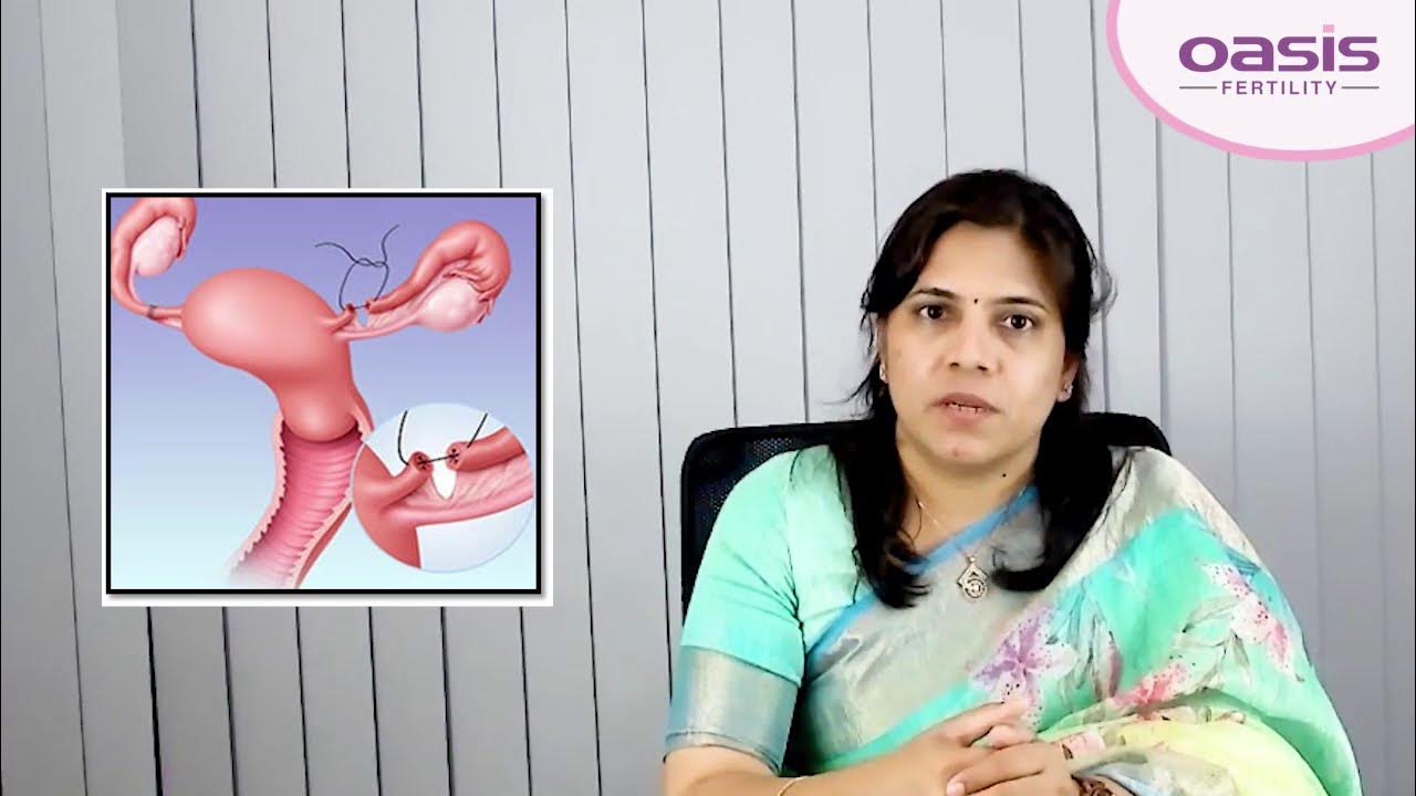 After Tubectomy the couple can get Pregnancy Oasis Fertility YouTube
