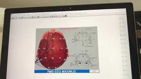 Maximus software installation