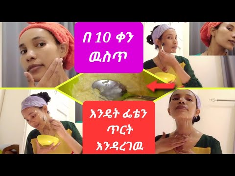 በ 10 ቀን ዉስጥ የፊት ቆዳን ጥርት ዉጥር ማረጊያ ፍቱን መላ የድንች ማስክ 100 Potato MASK For Face