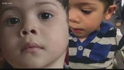 Family asking for help to find 3-year-old’s stolen prosthetic leg