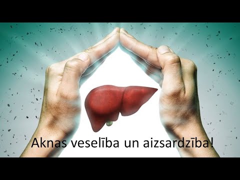 Video: Senās Pasaules Aknas - Alternatīvs Skats