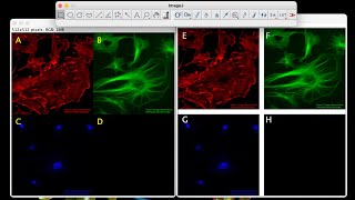 How to add Border to Montage Image in ImageJ| Magic Montage tool in ImageJ| Microscope Images